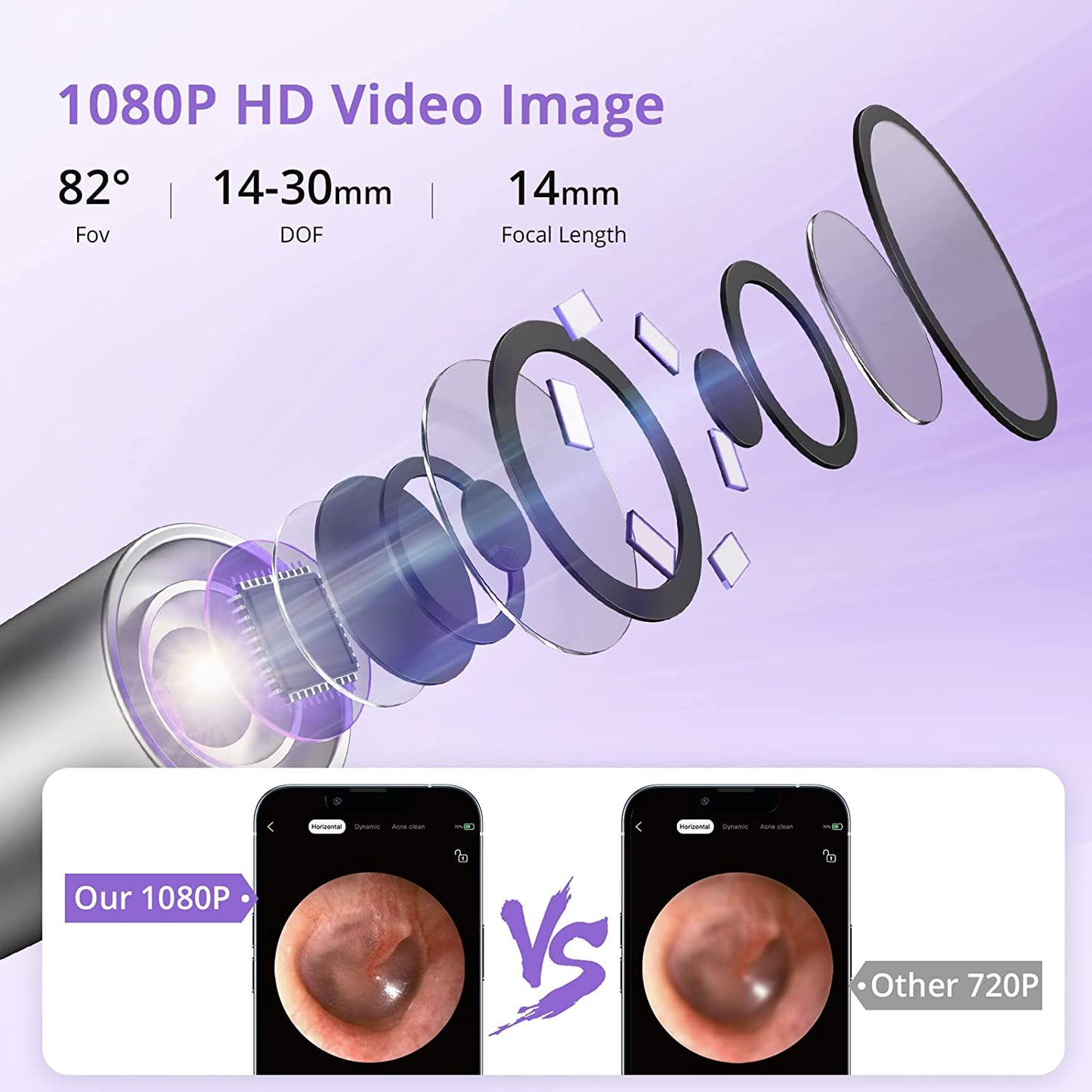 Acekool Ear Wax Removal EV1 - 1080P HD Ear Camera
