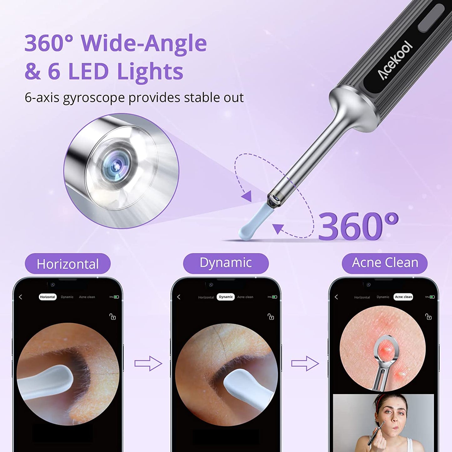 Acekool Ear Wax Removal EV1 - 1080P HD Ear Camera