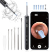Acekool Ear Wax Removal EV1 - 1080P HD Ear Camera