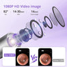 Acekool Ear Wax Removal EV1 - 1080P HD Ear Camera